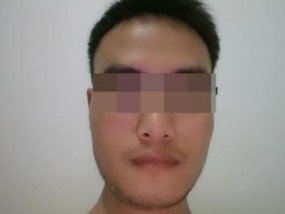 纯情轻颜相机如何在手机上使用？拍照技巧有哪些？