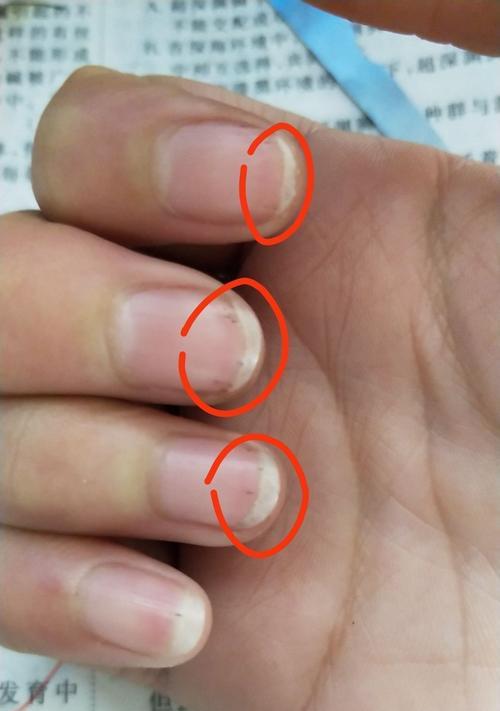 相机镜头有竖纹怎么办啊？如何清除镜头上的竖纹？  第2张