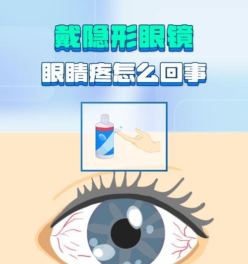 隐形眼镜视频教程在哪里找？驯服隐形眼镜的正确方法是什么？  第3张