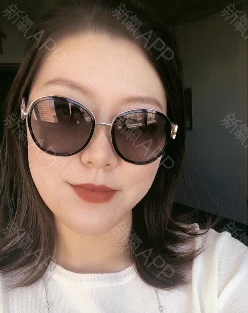 美颜相机眼镜参数如何调节？调整方法是什么？  第1张