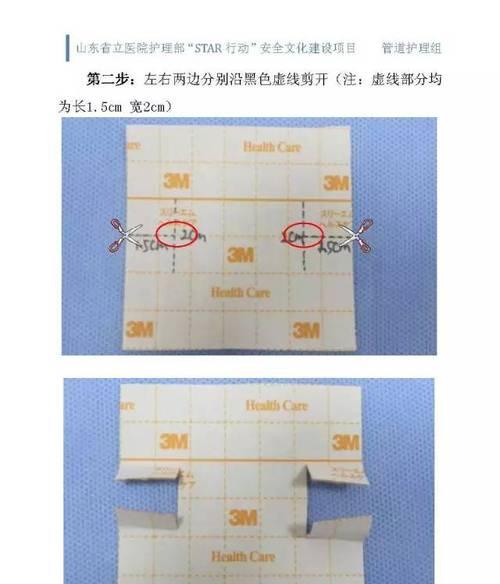 数据线圆圈固定的方法有哪些？  第2张