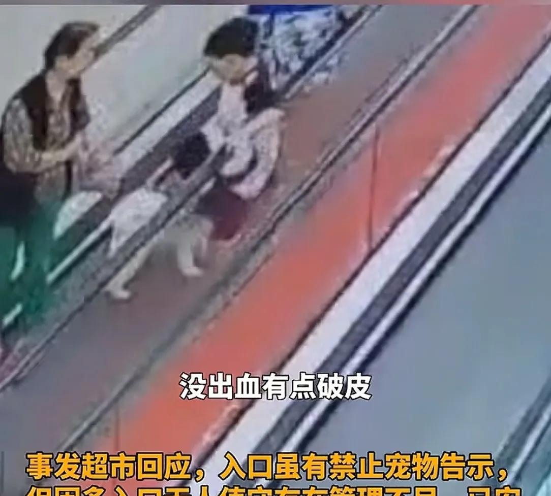 男孩商场扶梯上被狗咬伤，狗主人安慰几句后竟直接离开！警方介入  第4张